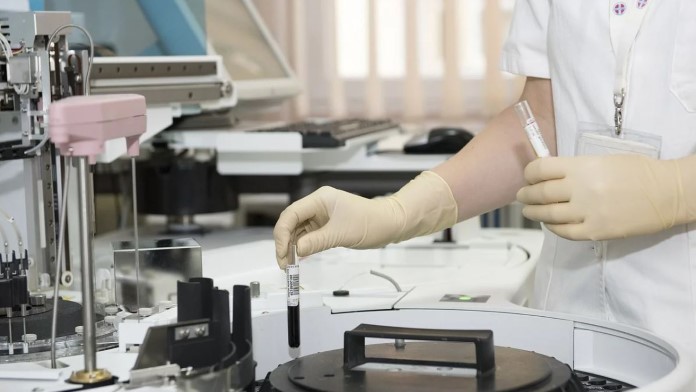 Ipotesi e complotti sul Coronavirus